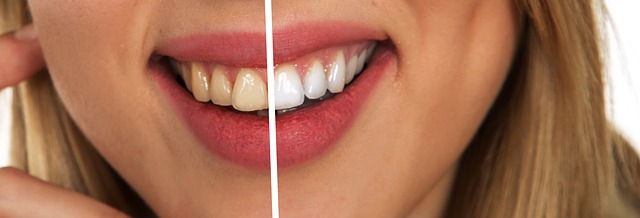 bílé a nažloutlé zuby